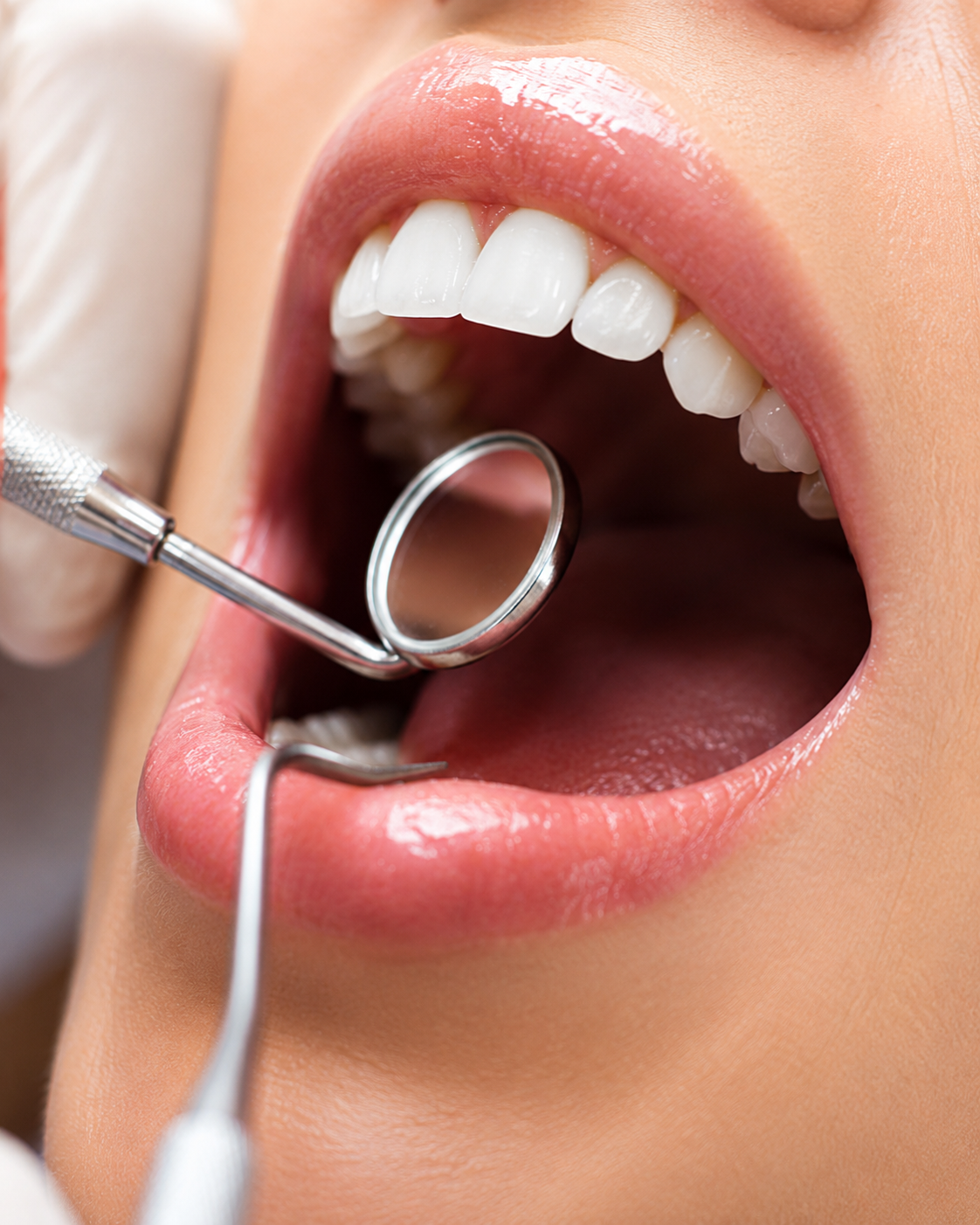Detailed dental examination